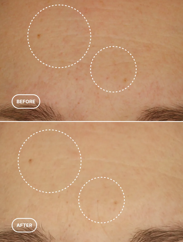 Retinol Alternative Serum