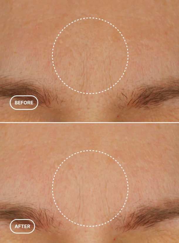 Retinol Alternative Moisturiser