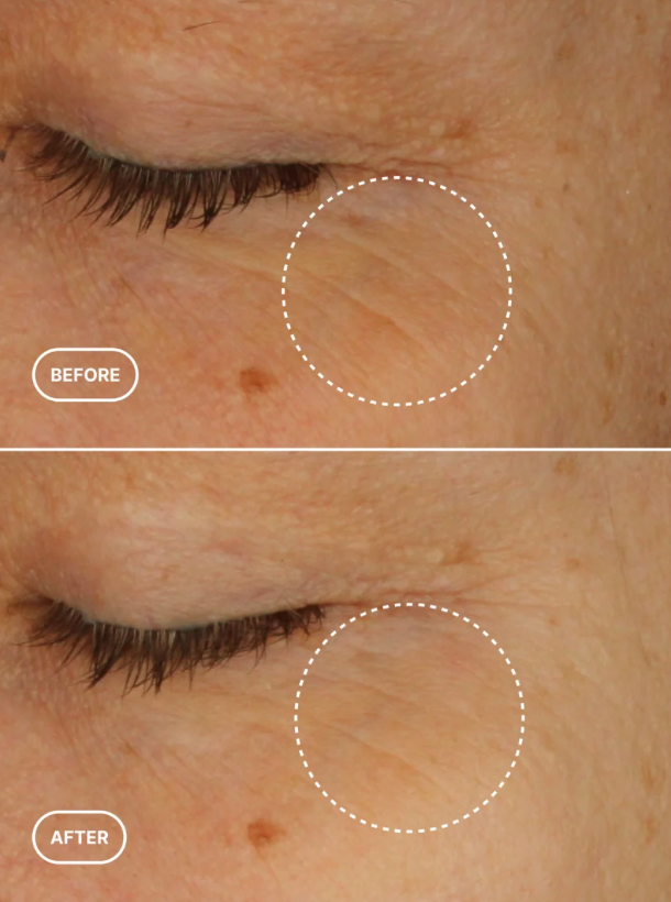 Retinol Alternative Eye Serum